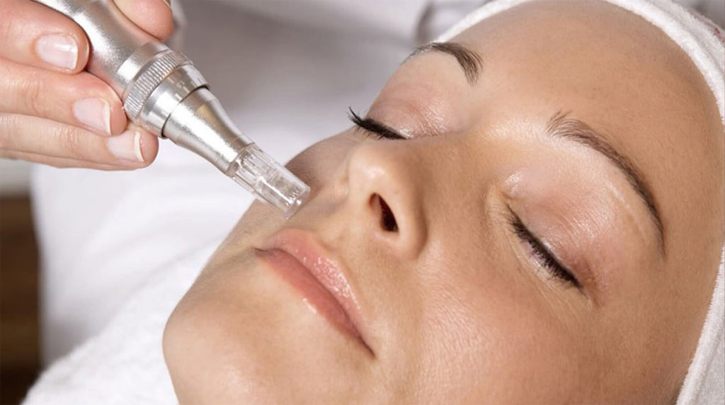 woman laying down, receiving professional microneedle treatment