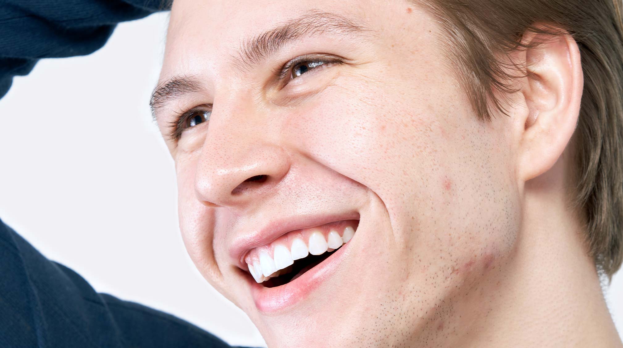 Cole wearing Micropoint for Blemishes
