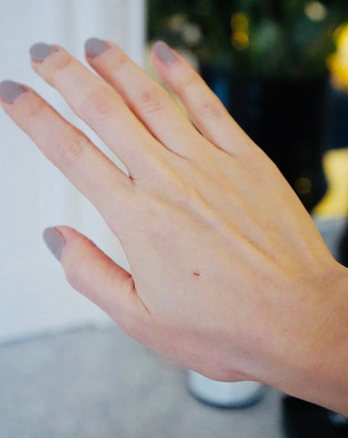 hand with a small cut