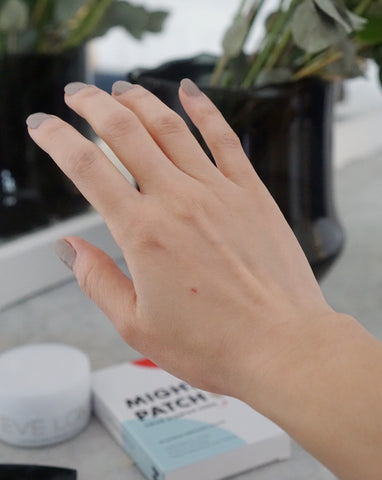 image of hand after peeling the patch