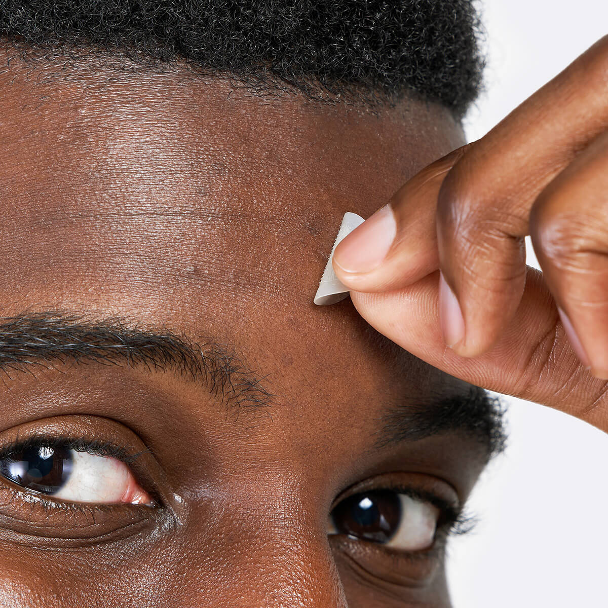 Marcus peeling off Micropoint for Dark Spots