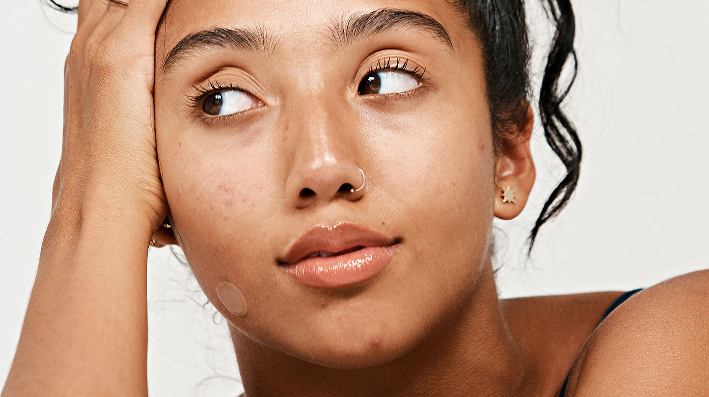 Manuela wearing micropoint for blemish early stage acne patch