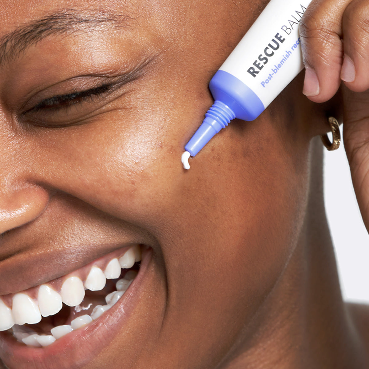Destina applying rescue balm
