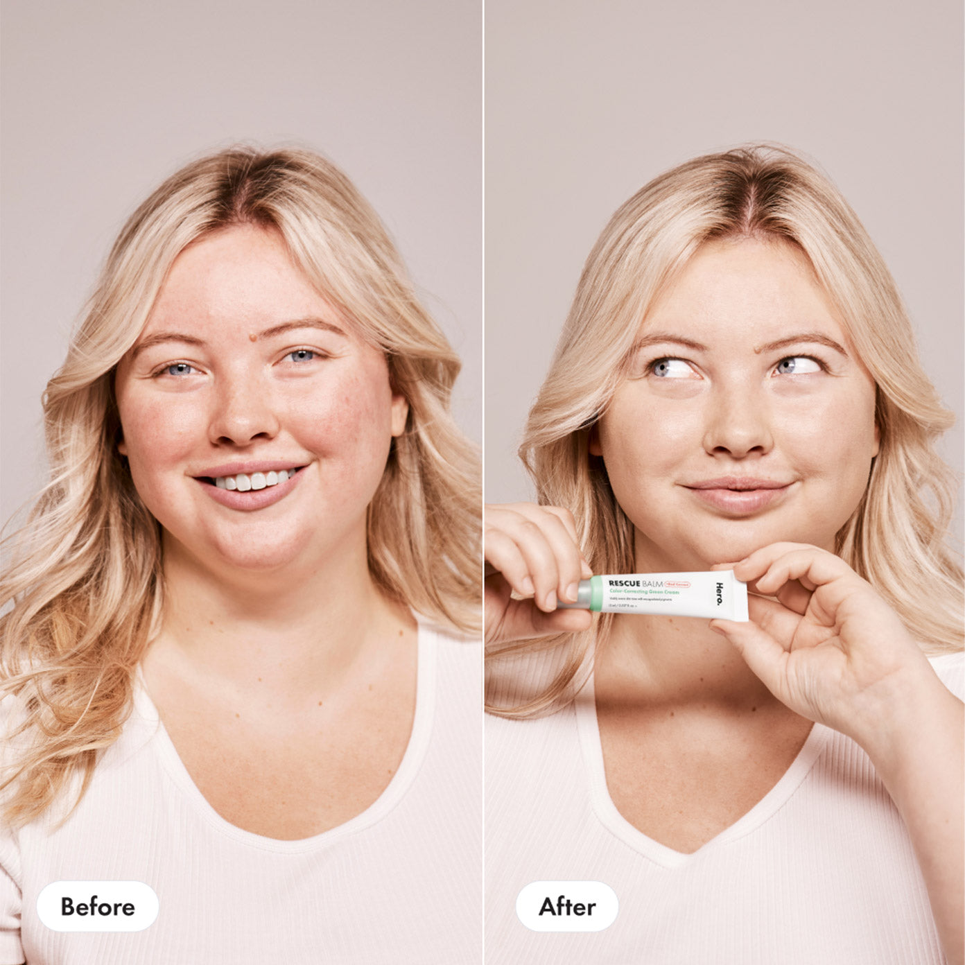 Before and After of Rescue Balm +Red Correct woman holding product