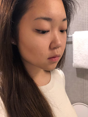 asian girl with mighty patch