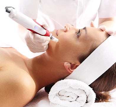 Woman receiving microneedling treatment with a professional