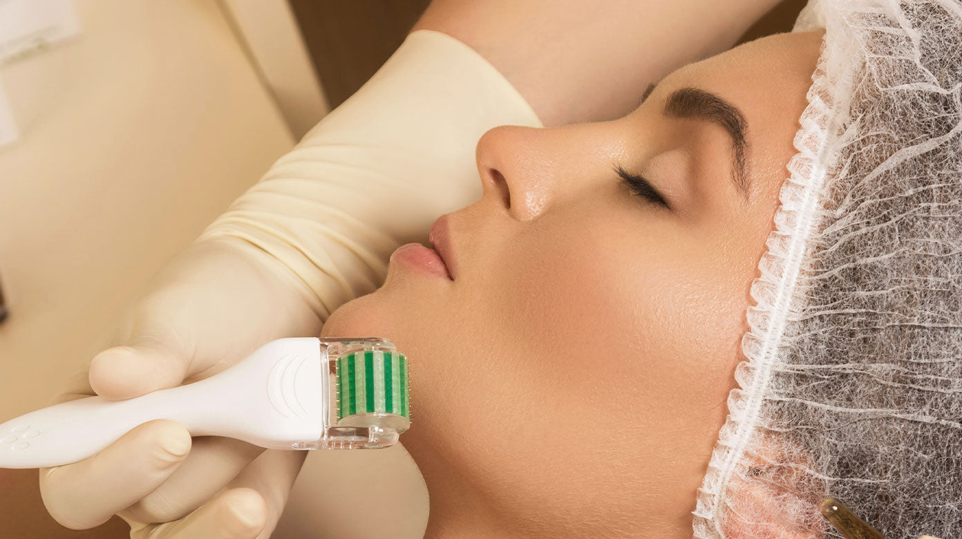 Microneedle roller device on woman's face