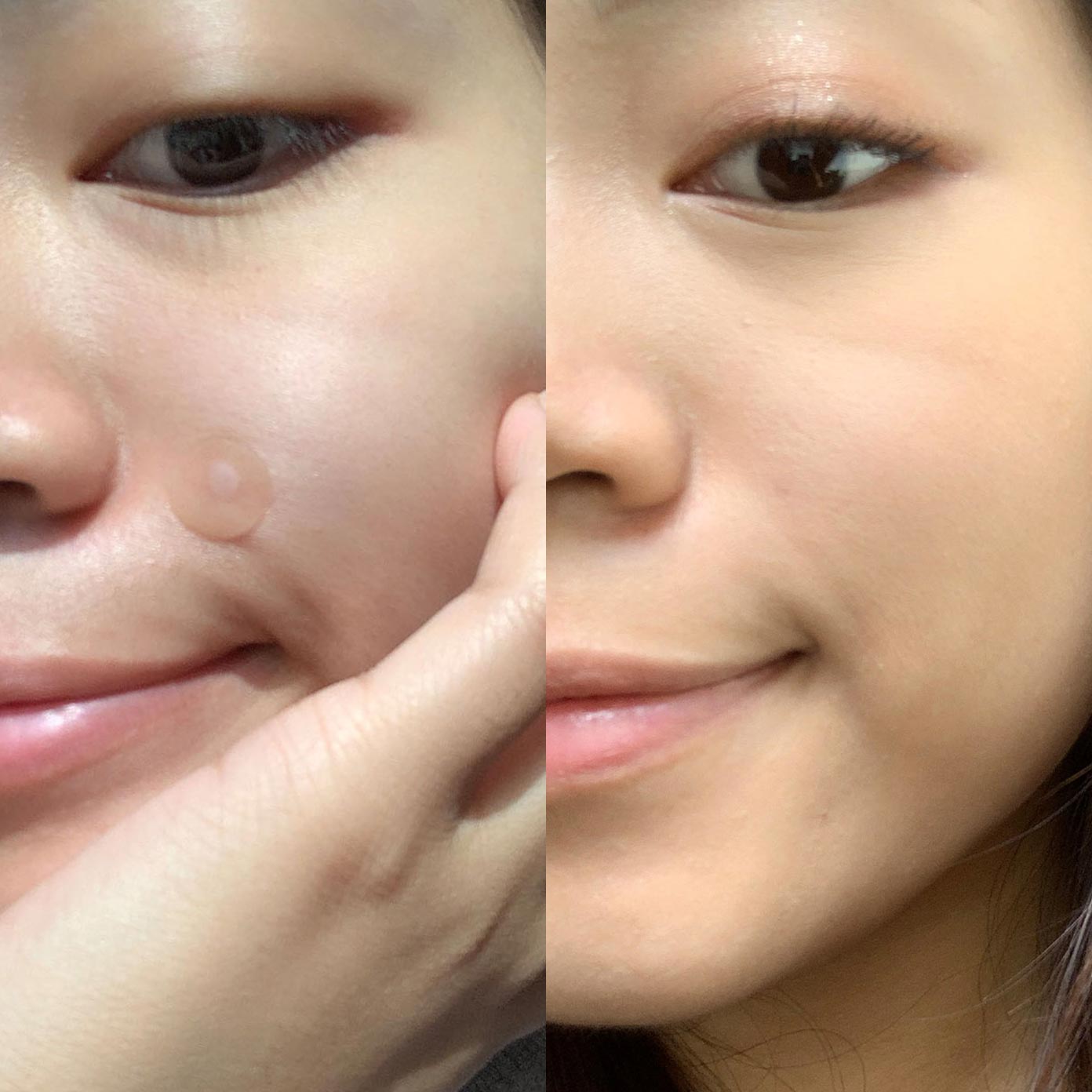 Before/After