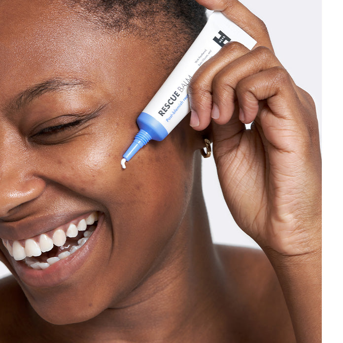 Destina applying rescue balm post pimple recovery cream to blemished irritated skin