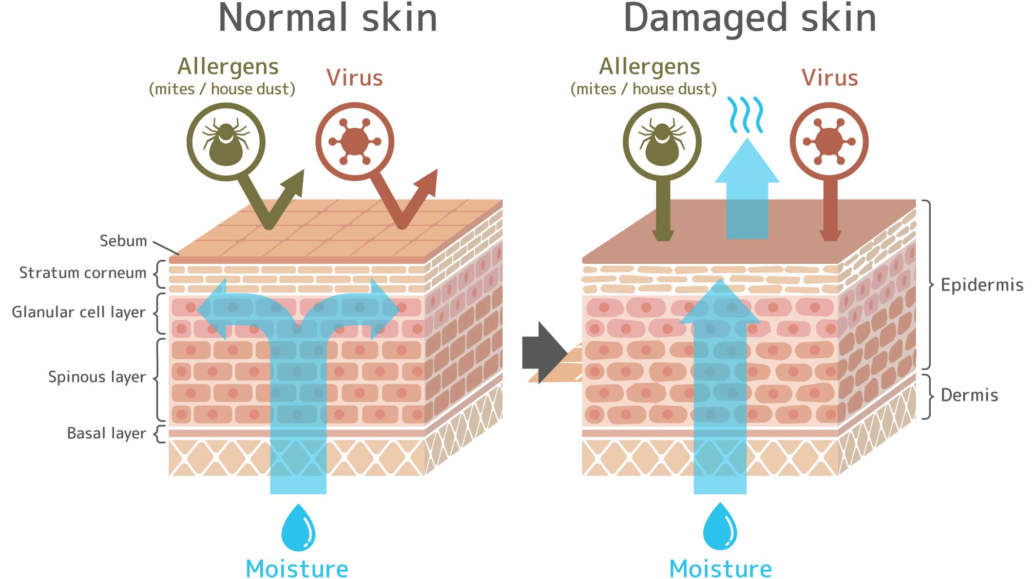 Skin barrier graphic