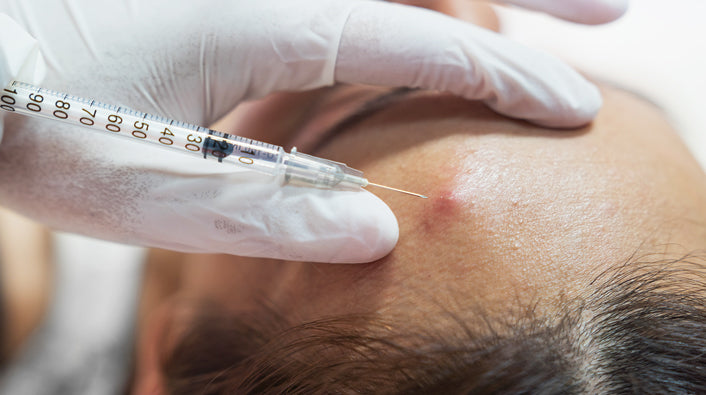 Stock image of person receiving cortisone shot