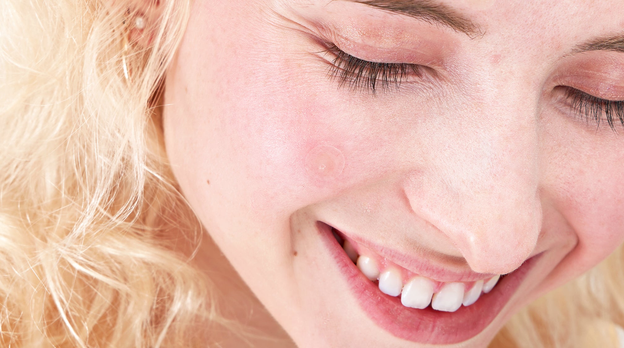 Should You Wear Makeup on Acne? Here’s the Scoop